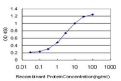 PTK9 Antibody (5C4), Novus Biologicals 0.1 mg | Buy Online | Novus Biologicals | Fisher Scientific