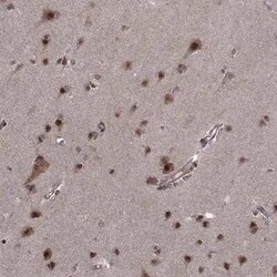 PTOV1 Antibody, Novus Biologicals:Antibodies:Primary Antibodies