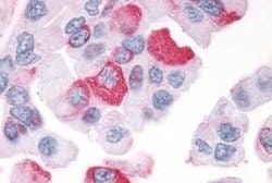 PTP alpha/PTPRA Antibody, Novus Biologicals 50 &mu;g | Buy Online | Novus Biologicals | Fisher Scientific