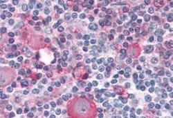 PTP alpha/PTPRA Antibody, Novus Biologicals 50 &mu;g | Buy Online | Novus Biologicals | Fisher Scientific