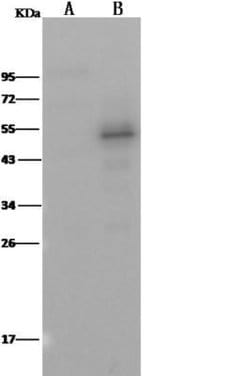 PTP1B/PTPN1 Rabbit anti-Human, Clone: 226, Novus Biologicals:Antibodies:Primary