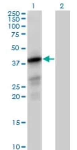 PTPLAD1 Antibody, Novus Biologicals 0.05 mg | Buy Online | Novus Biologicals | Fisher Scientific