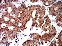 PTPN14/PTPD2 Antibody (2B3H7) - BSA Free, Novus Biologicals 0.1 ml; Unconjugated:Antibodies,