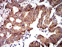 PTPN14/PTPD2 Antibody (2C12E3) - BSA Free, Novus Biologicals 0.1 ml; Unconjugated:Antibodies,