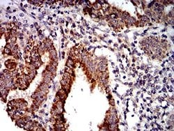 PTPN14/PTPD2 Antibody (2C12E3) - BSA Free, Novus Biologicals 0.1 ml; Unconjugated:Antibodies,