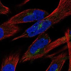 PTPN21 Antibody, Novus Biologicals 25ul; Unconjugated:Antibodies, Polyclonal