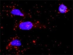 PTPN7 Antibody, Novus Biologicals 0.1 mg | Buy Online | Novus Biologicals | Fisher Scientific
