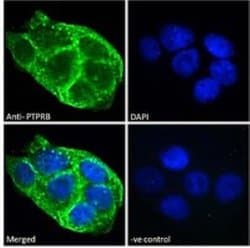 PTPRB Antibody, Novus Biologicals 0.1 mg; Unconjugated:Antibodies, Polyclonal