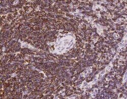 PTPRCAP Antibody, Novus Biologicals 50 &mu;g; Unconjugated:Antibodies,