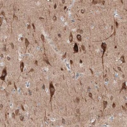 PTPRD Antibody, Novus Biologicals:Antibodies:Primary Antibodies