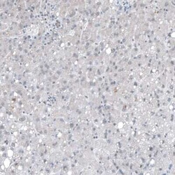 PTPRD Antibody, Novus Biologicals:Antibodies:Primary Antibodies