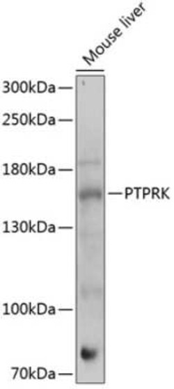 PTPRK Antibody - Azide and BSA Free, Novus Biologicals 0.02 mL | Buy Online | Novus Biologicals | Fisher Scientific