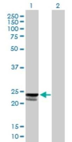 PTRH1 Antibody, Novus Biologicals 0.05 mg | Buy Online | Novus Biologicals | Fisher Scientific