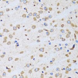 PTRH2 Antibody - BSA Free, Novus Biologicals 0.1 mL; Unconjugated:Antibodies,