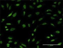 PTTG1 Antibody (3F9), Novus Biologicals 0.1 mg | Buy Online | Novus Biologicals | Fisher Scientific