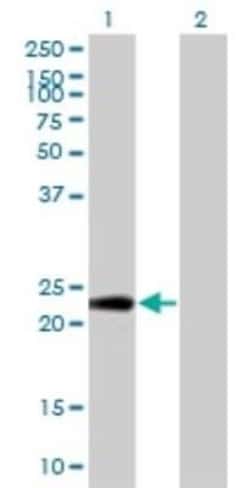 PTTG1IP Antibody (4C11), Novus Biologicals 0.1 mg | Buy Online | Novus Biologicals | Fisher Scientific