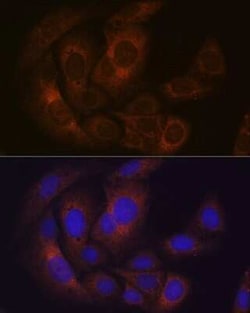 PUM1 Rabbit anti-Human, Mouse, Clone: 8Y6H5, Novus Biologicals 20 &mu;g | Buy Online | Novus Biologicals | Fisher Scientific