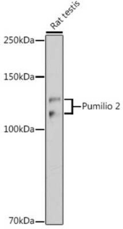 PUM2 Rabbit anti-Human, Mouse, Rat, Clone: 7M1B1, Novus Biologicals:Antibodies:Primary