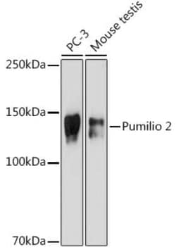 PUM2 Rabbit anti-Human, Mouse, Rat, Clone: 7M1B1, Novus Biologicals:Antibodies:Primary