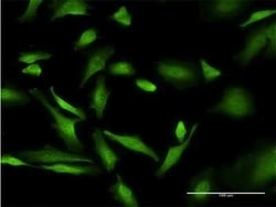 PURA Antibody (1D6), Novus Biologicals 0.1 mg, Unconjugated:Antibodies,