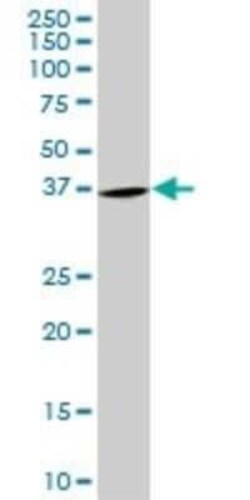 PURA Antibody (3F10), Novus Biologicals 0.1 mg | Buy Online | Novus Biologicals | Fisher Scientific