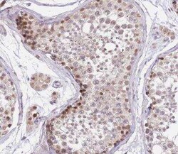 PUS10 Antibody, Novus Biologicals:Antibodies:Primary Antibodies
