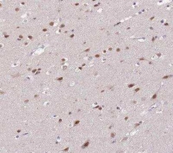 PUS10 Antibody, Novus Biologicals:Antibodies:Primary Antibodies