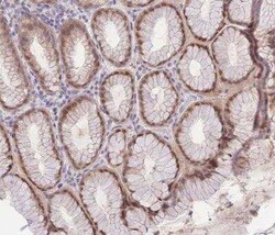 PUS10 Antibody, Novus Biologicals:Antibodies:Primary Antibodies
