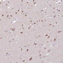 PUS10 Antibody, Novus Biologicals:Antibodies:Primary Antibodies