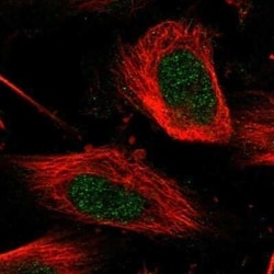 PUS7 Antibody, Novus Biologicals 0.1 mL | Buy Online | Novus Biologicals | Fisher Scientific