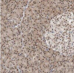 PUS7 Antibody, Novus Biologicals 0.1 mL | Buy Online | Novus Biologicals | Fisher Scientific