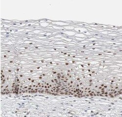 PUS7 Antibody, Novus Biologicals 0.1 mL | Buy Online | Novus Biologicals | Fisher Scientific