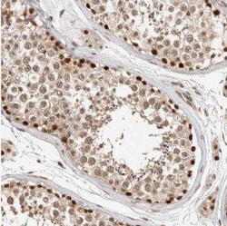 PUS7 Antibody, Novus Biologicals 0.1 mL | Buy Online | Novus Biologicals | Fisher Scientific