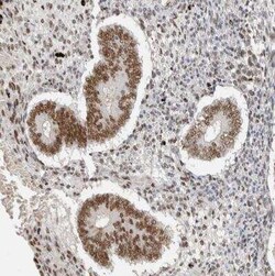 PUS7 Antibody, Novus Biologicals 0.1 mL | Buy Online | Novus Biologicals | Fisher Scientific