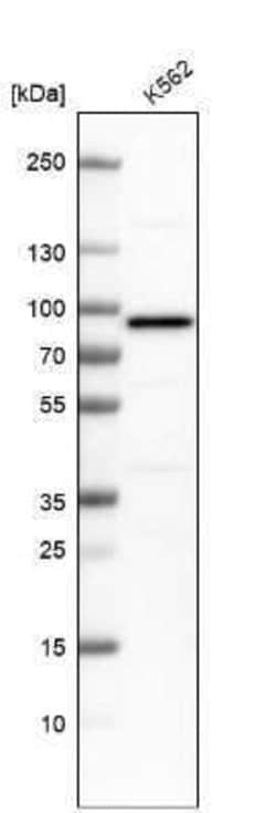 PUS7 Antibody, Novus Biologicals 0.1 mL | Buy Online | Novus Biologicals | Fisher Scientific