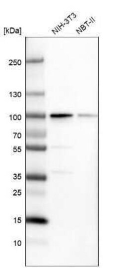 PUS7 Antibody, Novus Biologicals 0.1 mL | Buy Online | Novus Biologicals | Fisher Scientific