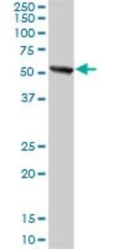 PWP1 Antibody, Novus Biologicals 0.1 mg | Buy Online | Novus Biologicals | Fisher Scientific