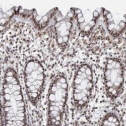 PWWP2B Rabbit anti-Human, Polyclonal, Novus Biologicals:Antibodies:Primary
