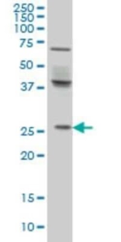PX19 Antibody (7B4), Novus Biologicals 0.1 mg | Buy Online | Novus Biologicals | Fisher Scientific