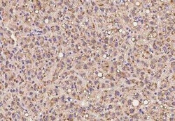 PXMP4 Antibody, Novus Biologicals 100 &mu;g; Unconjugated:Antibodies, Polyclonal