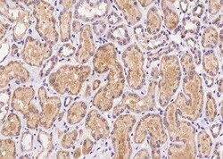PXMP4 Antibody, Novus Biologicals 100 &mu;g; Unconjugated:Antibodies, Polyclonal
