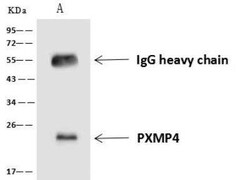PXMP4 Antibody, Novus Biologicals 100 &mu;g; Unconjugated:Antibodies, Polyclonal