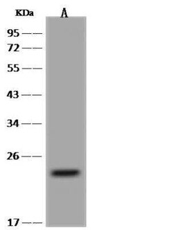 PXMP4 Antibody, Novus Biologicals 100 &mu;g; Unconjugated:Antibodies, Polyclonal