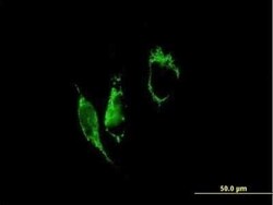 PYCR1 Antibody, Novus Biologicals 0.05 mg, Unconjugated:Antibodies, Polyclonal