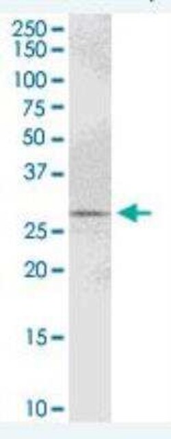 PYCR1 Antibody, Novus Biologicals 0.05 mg, Unconjugated:Antibodies, Polyclonal