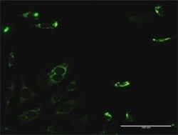 PYCR2 Antibody, Novus Biologicals 0.1 mg | Buy Online | Novus Biologicals | Fisher Scientific