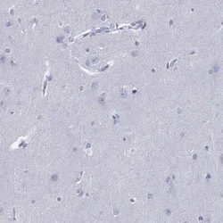 PYHIN1 Rabbit anti-Human, Polyclonal, Novus Biologicals 25 &mu;g; Unconjugated:Antibodies,