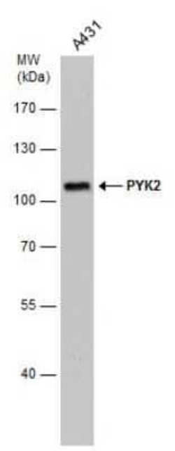 PYK2/FAK2 Antibody (GT1132), Novus Biologicals 100 &mu;g | Buy Online | Novus Biologicals | Fisher Scientific
