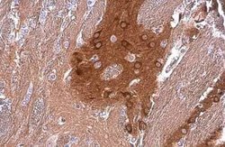 PYK2/FAK2 Antibody (GT858), Novus Biologicals 100 &mu;g | Buy Online | Novus Biologicals | Fisher Scientific