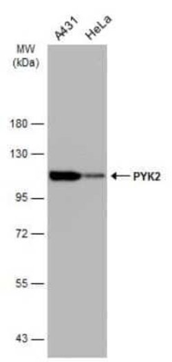 PYK2/FAK2 Antibody (GT858), Novus Biologicals 100 &mu;g | Buy Online | Novus Biologicals | Fisher Scientific